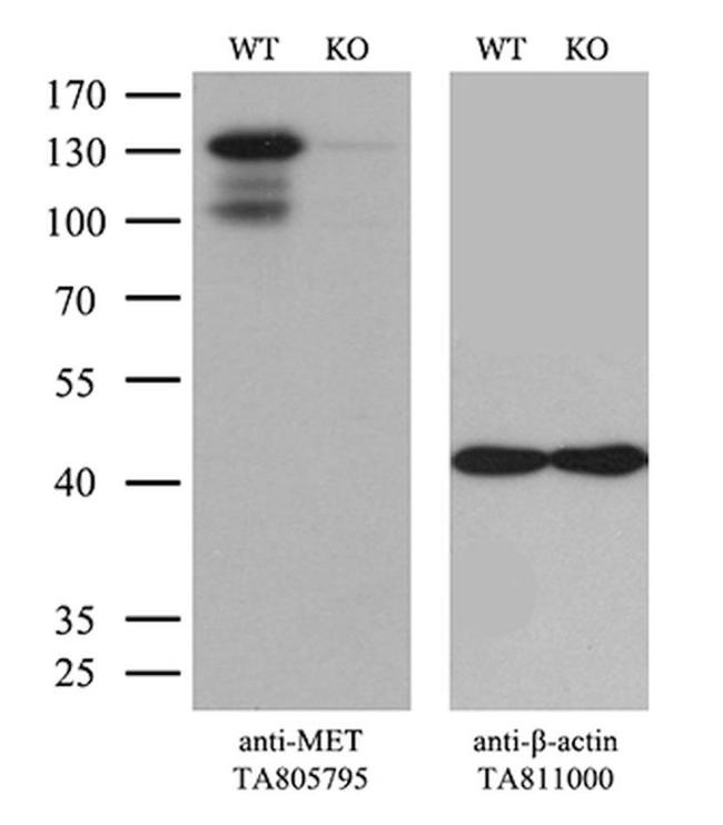 MET Antibody in Western Blot (WB)