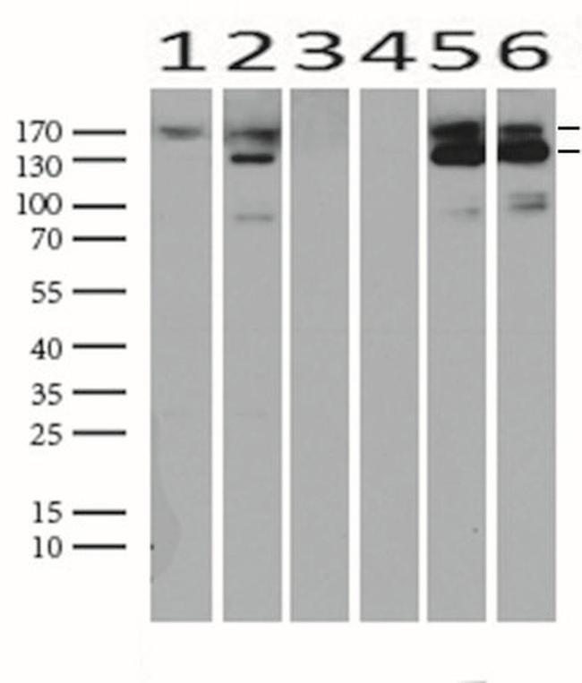 MET Antibody in Western Blot (WB)