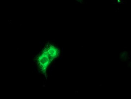 METAP2 Antibody in Immunocytochemistry (ICC/IF)