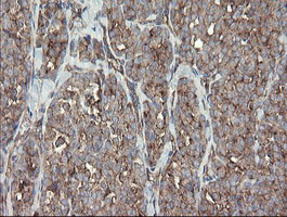 METAP2 Antibody in Immunohistochemistry (Paraffin) (IHC (P))