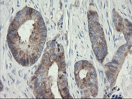 METAP2 Antibody in Immunohistochemistry (Paraffin) (IHC (P))