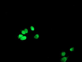 METT10D Antibody in Immunocytochemistry (ICC/IF)