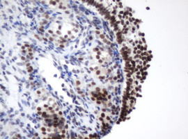 METT10D Antibody in Immunohistochemistry (Paraffin) (IHC (P))