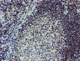 METT10D Antibody in Immunohistochemistry (Paraffin) (IHC (P))