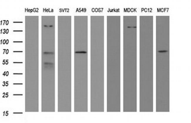 METT10D Antibody in Western Blot (WB)