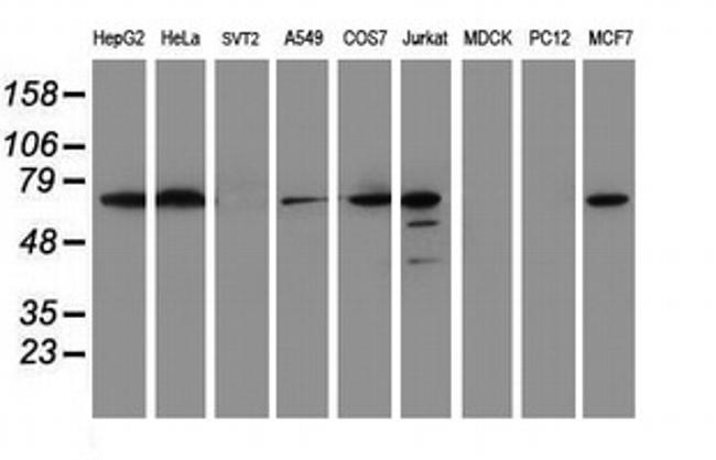 METT10D Antibody in Western Blot (WB)