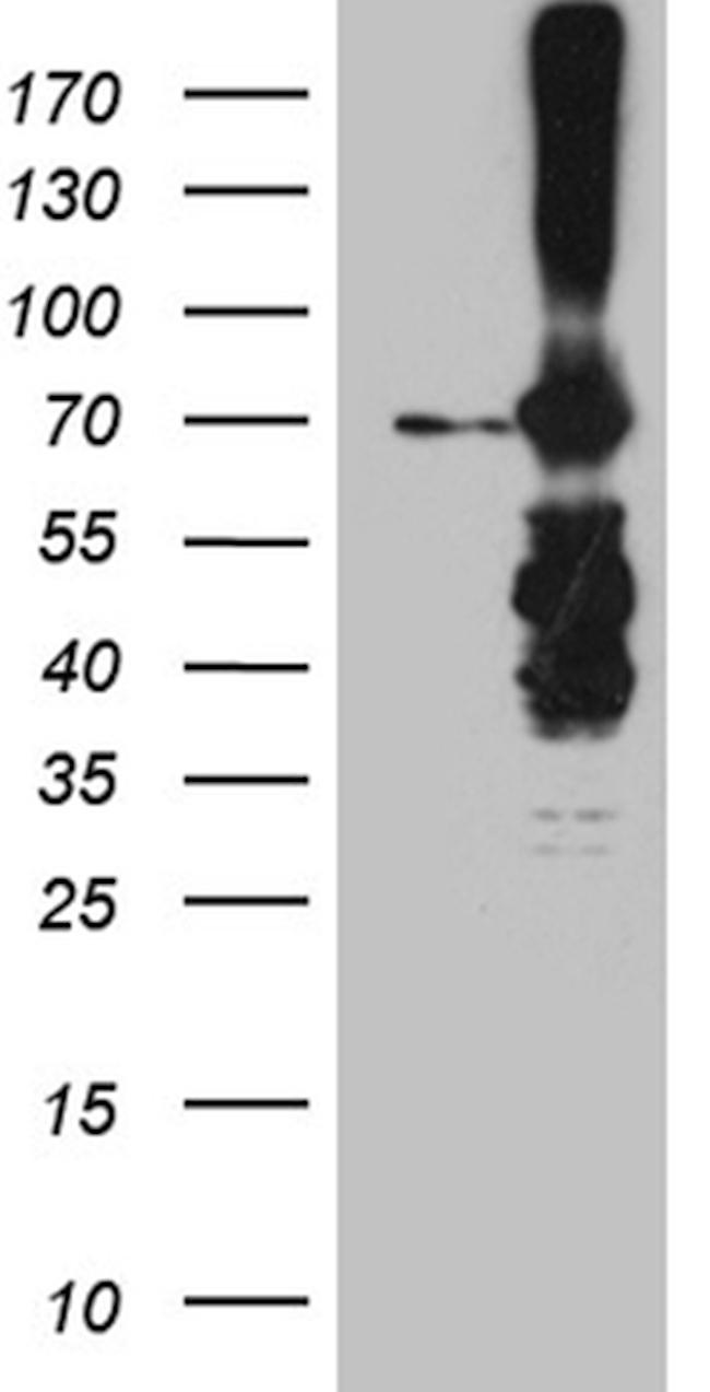 METTL3 Antibody in Western Blot (WB)