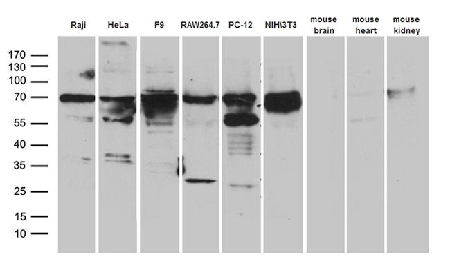 METTL3 Antibody in Western Blot (WB)