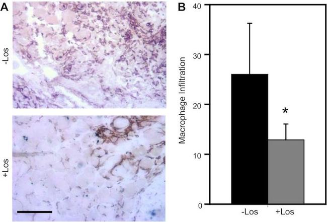 F4/80 Antibody in Immunohistochemistry (IHC)