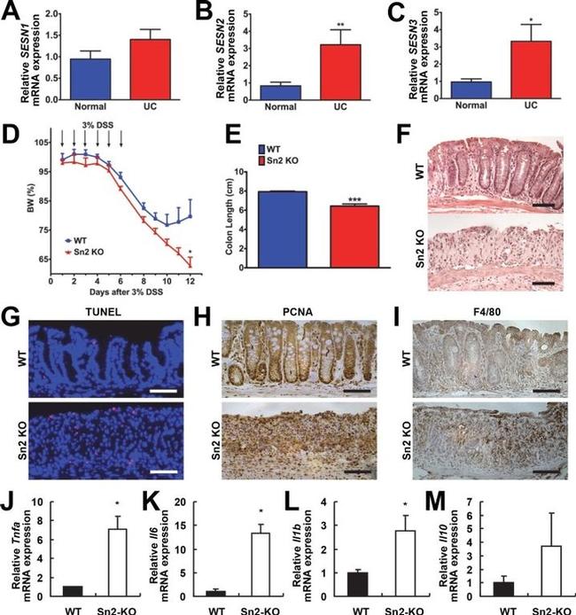 F4/80 Antibody in Immunohistochemistry (Paraffin) (IHC (P))