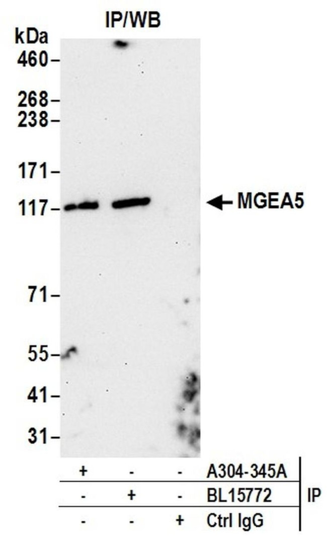 MGEA5 Antibody in Immunoprecipitation (IP)