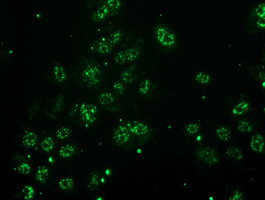 MGLL Antibody in Immunocytochemistry (ICC/IF)