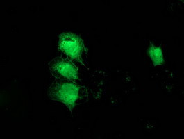 MGLL Antibody in Immunocytochemistry (ICC/IF)