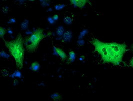 MGLL Antibody in Immunocytochemistry (ICC/IF)