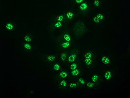 MGLL Antibody in Immunocytochemistry (ICC/IF)