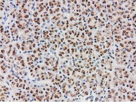 MGLL Antibody in Immunohistochemistry (Paraffin) (IHC (P))