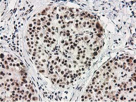 MGLL Antibody in Immunohistochemistry (Paraffin) (IHC (P))