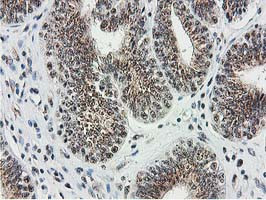 MGLL Antibody in Immunohistochemistry (Paraffin) (IHC (P))