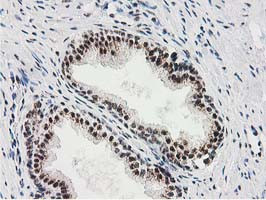 MGLL Antibody in Immunohistochemistry (Paraffin) (IHC (P))