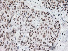 MGLL Antibody in Immunohistochemistry (Paraffin) (IHC (P))