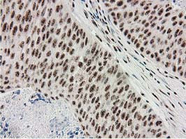 MGLL Antibody in Immunohistochemistry (Paraffin) (IHC (P))