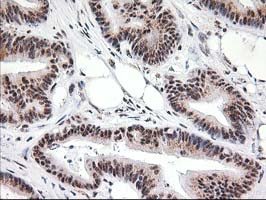 MGLL Antibody in Immunohistochemistry (Paraffin) (IHC (P))