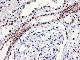 MGLL Antibody in Immunohistochemistry (Paraffin) (IHC (P))