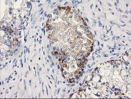 MGLL Antibody in Immunohistochemistry (Paraffin) (IHC (P))