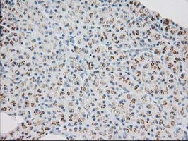 MGLL Antibody in Immunohistochemistry (Paraffin) (IHC (P))