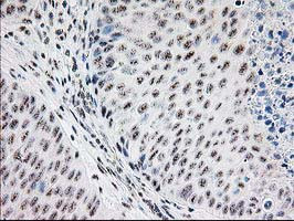 MGLL Antibody in Immunohistochemistry (Paraffin) (IHC (P))