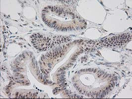 MGLL Antibody in Immunohistochemistry (Paraffin) (IHC (P))