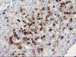 MGLL Antibody in Immunohistochemistry (Paraffin) (IHC (P))