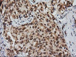 MGLL Antibody in Immunohistochemistry (Paraffin) (IHC (P))