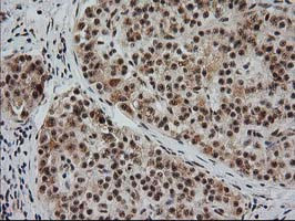 MGLL Antibody in Immunohistochemistry (Paraffin) (IHC (P))