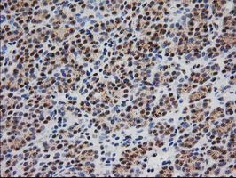 MGLL Antibody in Immunohistochemistry (Paraffin) (IHC (P))