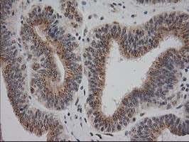 MGLL Antibody in Immunohistochemistry (Paraffin) (IHC (P))