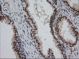 MGLL Antibody in Immunohistochemistry (Paraffin) (IHC (P))