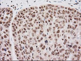 MGLL Antibody in Immunohistochemistry (Paraffin) (IHC (P))