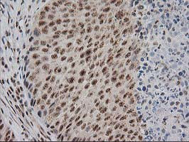 MGLL Antibody in Immunohistochemistry (Paraffin) (IHC (P))