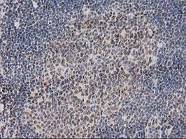 MGLL Antibody in Immunohistochemistry (Paraffin) (IHC (P))