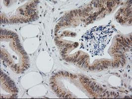 MGLL Antibody in Immunohistochemistry (Paraffin) (IHC (P))