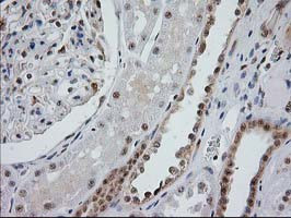 MGLL Antibody in Immunohistochemistry (Paraffin) (IHC (P))