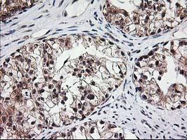 MGLL Antibody in Immunohistochemistry (Paraffin) (IHC (P))