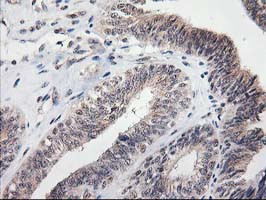 MGLL Antibody in Immunohistochemistry (Paraffin) (IHC (P))