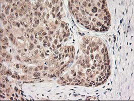 MGLL Antibody in Immunohistochemistry (Paraffin) (IHC (P))