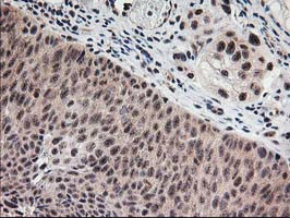 MGLL Antibody in Immunohistochemistry (Paraffin) (IHC (P))