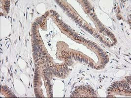 MGLL Antibody in Immunohistochemistry (Paraffin) (IHC (P))