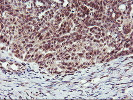 MGLL Antibody in Immunohistochemistry (Paraffin) (IHC (P))