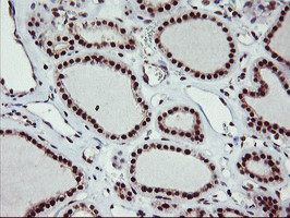 MGLL Antibody in Immunohistochemistry (Paraffin) (IHC (P))