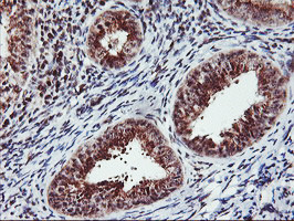 MGLL Antibody in Immunohistochemistry (Paraffin) (IHC (P))